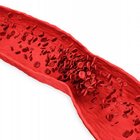Afbeelding van cursus Antitrombotica: verdieping en klinische toepassingen