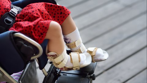 Afbeelding van cursus Neuromusculaire aandoeningen in de kinderfysiotherapie