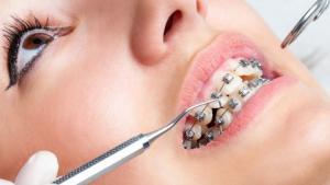 Afbeelding van cursus Orthodontie
