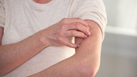 Afbeelding van cursus Jeuk bij ouderen
