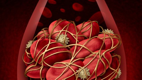 Afbeelding van cursus Antitrombotica: verdieping en klinische toepassingen