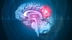 Afbeelding van cursus Beweeggedrag na een beroerte: elke beweging telt!