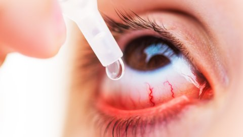 Afbeelding van cursus Oogaandoeningen en medicatie