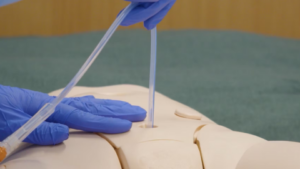 Afbeelding van cursus Suprapubische verblijfskatheter verwijderen - met een schone fistelopening
