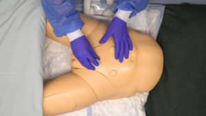 Afbeelding van cursus Suprapubische verblijfskatheter verwijderen - met een geïrriteerde fistelopening