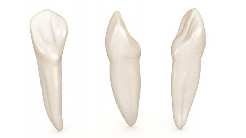 Afbeelding van cursus Fronttandvervanging middels autotransplantaten