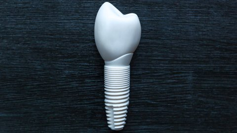 Afbeelding van cursus Zirkonia-implantaten