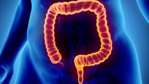 Afbeelding van cursus Chronische inflammatoire darmziekten: de ziekte van Crohn en colitis ulcerosa